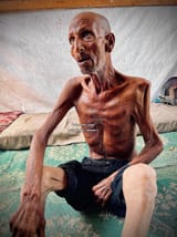 starvation gaza