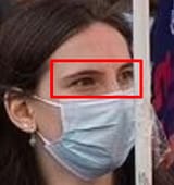The eyes