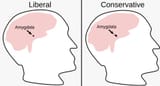 Amygdala3