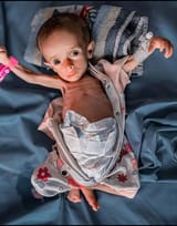 gaza famine852
