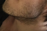 Chin