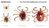 Lone Star Tick - Alpha Gal Syndrome