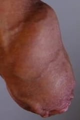 1741654340525911