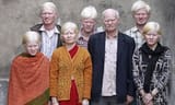 indian albino family