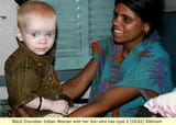 albino son