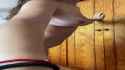 18 year old braces_thumb.jpg