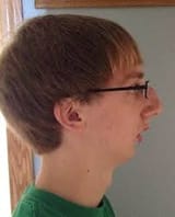 chin