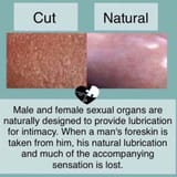 intact_vs_circ