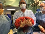 lab meat tumor