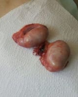 Bye bye balls