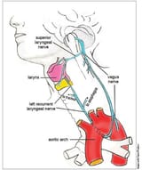 ev_blunder_laryngeal_nerve_pic