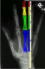 Golden-ratio-in-human-hand-2706935846