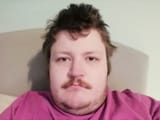 Unusual Phenotype