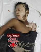 Dead Gaza nigger turned white lol