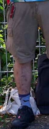 doomleg