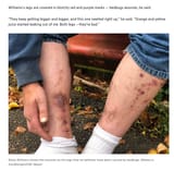 bedbugs