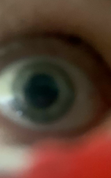 77