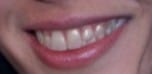 wtf teeth