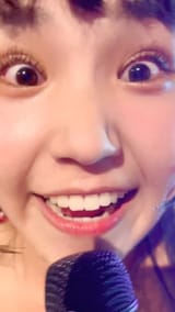 WOI