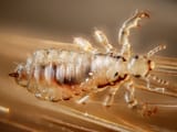 sn-headlice