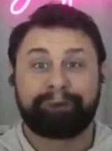 srs