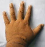 my hand
