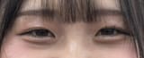 little peach eyes