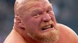 brock-lesnar-teeth-hollywood-smile-before-after