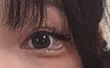 eye