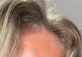 5 head