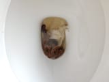 poop