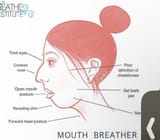 mouth-breather-v0-q6w21c01asad1