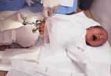 circumcision