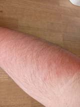 IMG_20250620_083112924-min