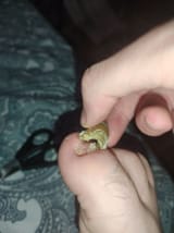 nail coming off