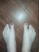 both feet