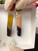 average weight vs obese blood centrifuge