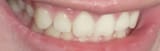 teeth