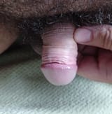 Uncut_flaccid~2