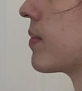 chin