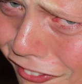 maxresdefault
