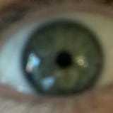 eye