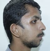 1736182862604223