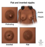 flat-inverted-nipples