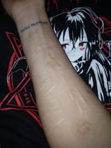 Alive
