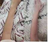 nair befoere and after