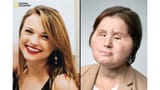 180810162525-02-face-transplant-katie-stubblefield-restricted