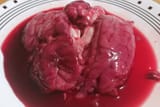 brain2