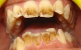 5bd6ffa0ed67ad0001fb74c0-3897109889