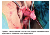 female circumcision